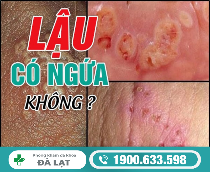 Hình ảnh minh họa